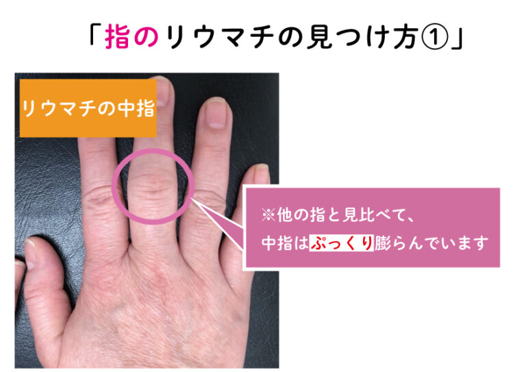 既存の診断に関する質問