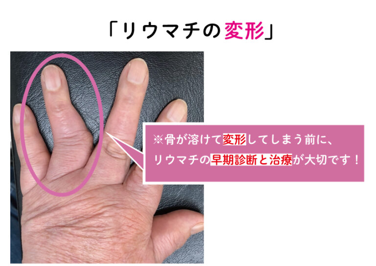 3. 保険に変更がある場合